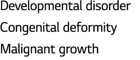 Developmental disorder Congenital deformity Malignant growth